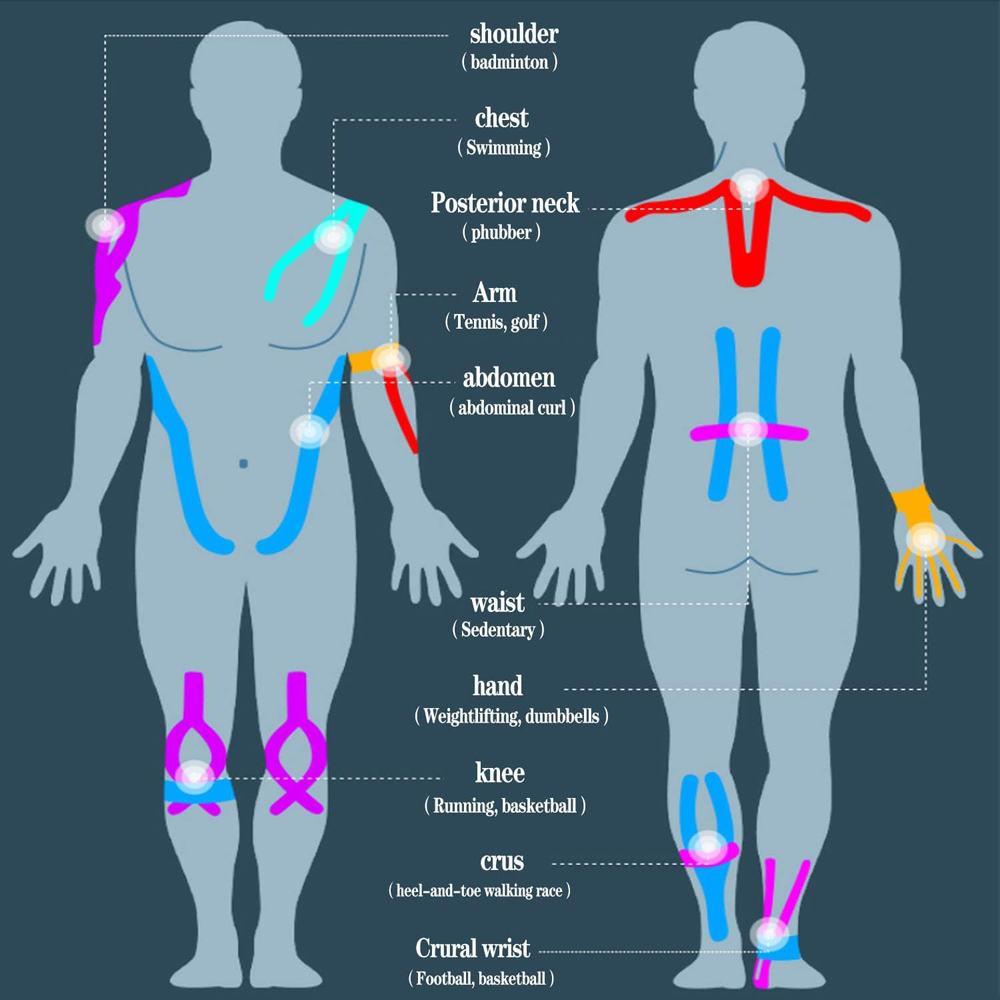 10 stuks voorgeknipte kinesiol - Kinesiology Tape Sports recensie en prijs